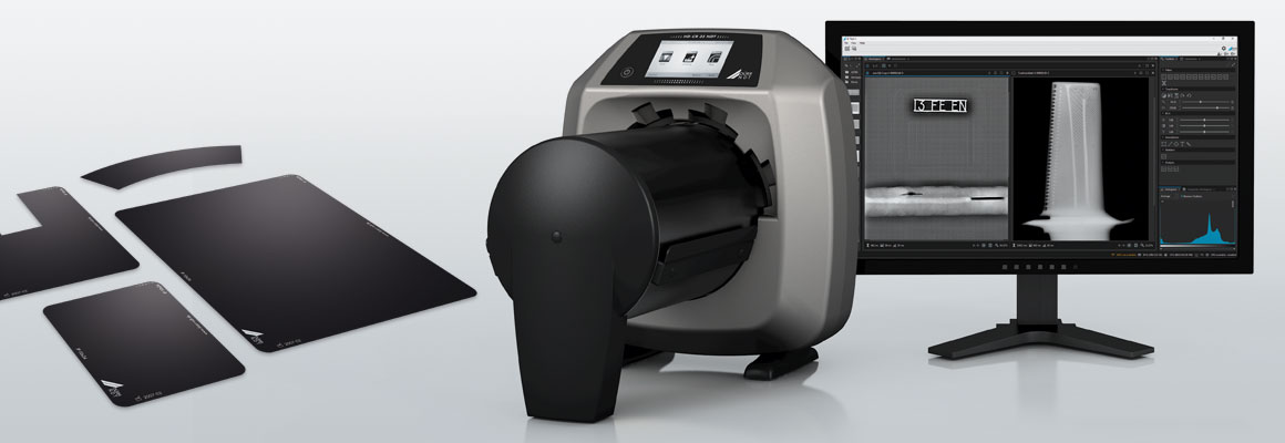 Best Practices For Implementing Computed Radiography