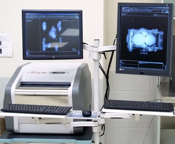 Advantages of Computed Radiography